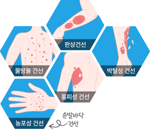 section5_hexagon1